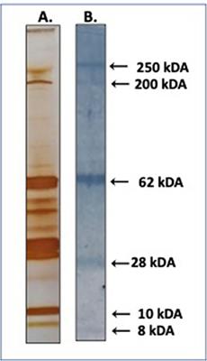 Antibody Responses Against Anopheles darlingi Immunogenic Peptides in Plasmodium Infected Humans